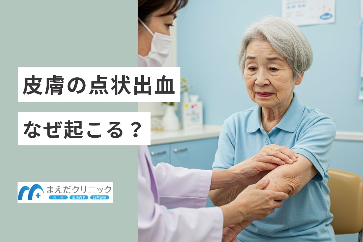 皮膚の点状出血はなんで起こる？
